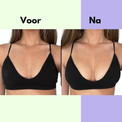 Novella™ Zelfklevende Cupvergroters - Perfect voor in je bikini!👙